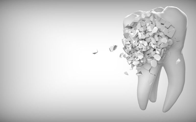 Fix Chipped or Cracked Teeth