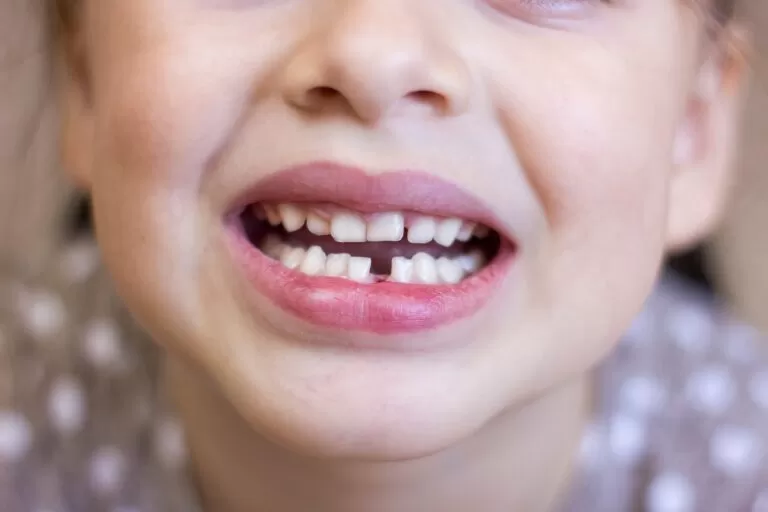 child tooth fell out